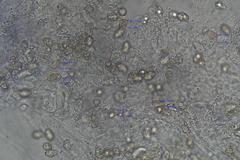 Entoloma melanophthalmum