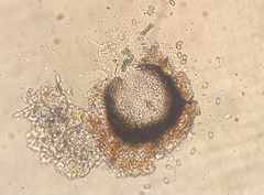 Muellerella lichenicola