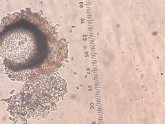 Muellerella lichenicola