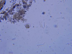 Vorticella