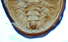 Tetraleurodes perileuca