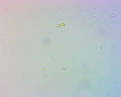 Monoraphidium contortum