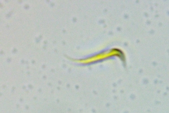 Monoraphidium contortum