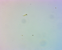 Monoraphidium contortum