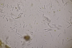 Discogloeum veronicae