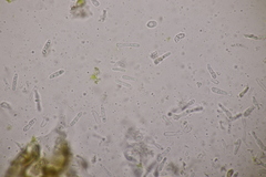 Discogloeum veronicae