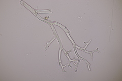 Peronospora galii
