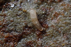 Caecum