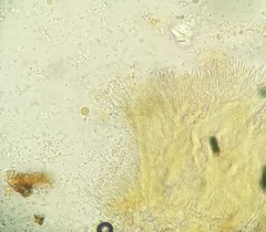 Bionectriaceae