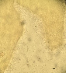 Bionectriaceae