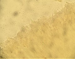 Bionectriaceae