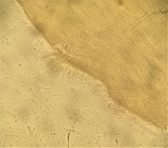 Bionectriaceae