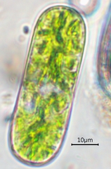 Cylindrocystis