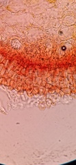Puccinia xanthii