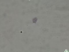 Microcystaceae