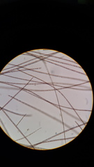 Planktothrix rubescens