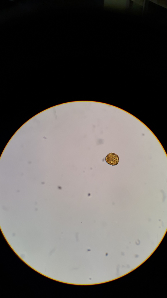 Gonyaulax spinifera