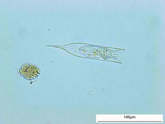 Amphorellopsis