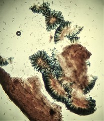 Sclerococcum stygium