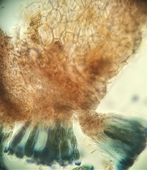 Sclerococcum stygium