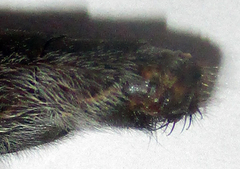 Centroclisis