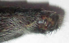 Centroclisis