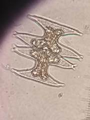 Micrasterias pinnatifida