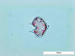 Protoperidinium