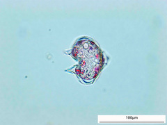 Protoperidinium
