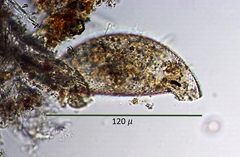 Cyphoderia ampulla