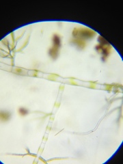 Draparnaldia glomerata