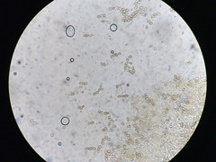 Naucoria escharioides