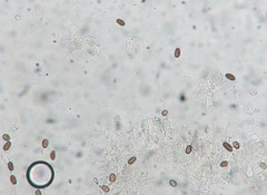 Coprinopsis canoceps