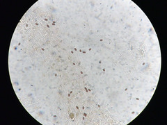 Coprinopsis canoceps