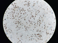 Coprinopsis canoceps