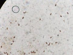 Coprinopsis canoceps