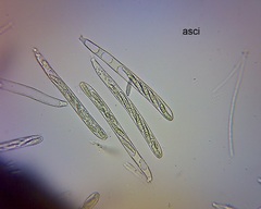 Leotiomycetes