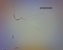 Leotiomycetes