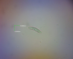 Leotiomycetes
