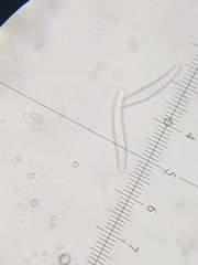 Cresponea plurilocularis