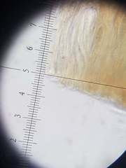 Cresponea plurilocularis