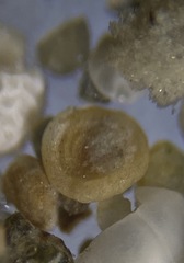Glomospira gordialis
