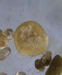 Glomospira gordialis
