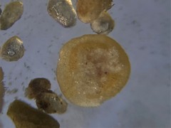 Glomospira gordialis