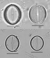 Cocconeis placentula