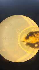 Acariformes