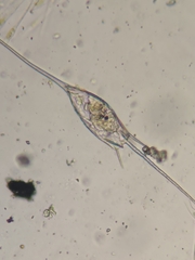 Kellicottia bostoniensis