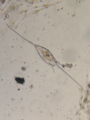 Kellicottia bostoniensis