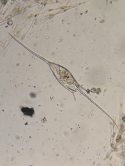 Kellicottia bostoniensis