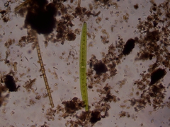 Closterium acerosum
